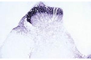 Immunohistochemical staining of Trpv2 in rat dorsal horn using Trpv2 polyclonal antibody . (TRPV2 抗体  (AA 744-761))