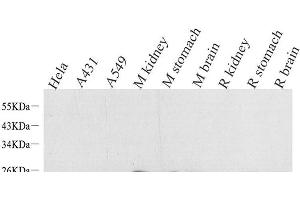 Western Blot analysis of various samples using NTS Polyclonal Antibody at dilution of 1:1000. (Neurotensin 抗体)