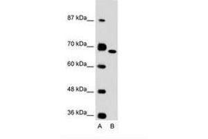Image no. 1 for anti-Fibronectin 1 (FN1) (C-Term) antibody (ABIN6736615) (Fibronectin 1 抗体  (C-Term))