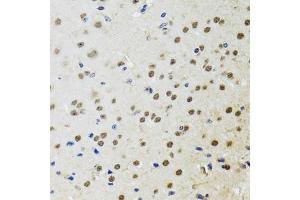 Immunohistochemistry of paraffin-embedded mouse brain using BTK antibody (ABIN3022170, ABIN3022171, ABIN3022172 and ABIN6218643) at dilution of 1:100 (40x lens). (BTK 抗体  (AA 30-240))
