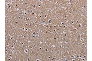 The image on the left is immunohistochemistry of paraffin-embedded Human brain tissue using ABIN7130211(MECP2 Antibody) at dilution 1/60, on the right is treated with fusion protein. (MECP2 抗体)
