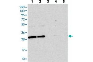 Western blot analysis of Lane 1: RT-4, Lane 2: U-251 MG, Lane 3: Human Plasma, Lane 4: Liver, Lane 5: Tonsil with BCDIN3D polyclonal antibody  at 1:250-1:500 dilution. (BCDIN3D 抗体)