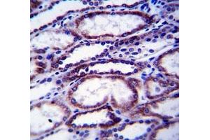 Immunohistochemistry (IHC) image for anti-Collagen, Type I, alpha 1 (COL1A1) (AA 1077-1106) antibody (ABIN3030548)