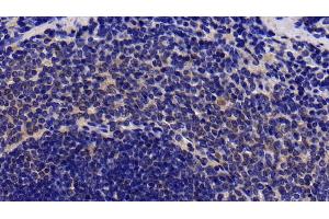 Detection of IL1R1 in Rat Spleen Tissue using Polyclonal Antibody to Interleukin 1 Receptor Type I (IL1R1) (IL1R1 抗体  (AA 226-352))