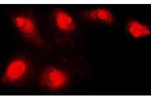 Immunofluorescent analysis of Histone Deacetylase 5 staining in Jurkat cells. (HDAC5 抗体  (C-Term))
