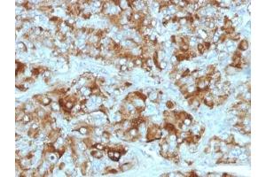 Formalin-fixed, paraffin-embedded adrenal gland stained with Chromogranin A antibody cocktail