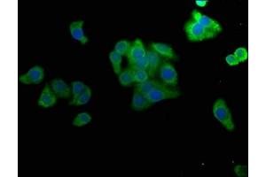 Immunofluorescence staining of HepG2 cells with ABIN7160070 at 1:50, counter-stained with DAPI. (MAP4K4 抗体  (AA 866-1104))