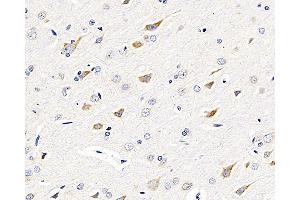 Immunohistochemistry analysis of paraffin-embedded rat brain using GRIN2B Polyclonal Antibody at dilution of 1:200. (GRIN2B 抗体)