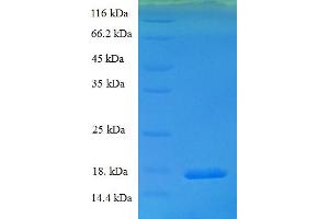 SDS-PAGE (SDS) image for Potassium Voltage-Gated Channel, Isk-Related Family, Member 2 (KCNE2) (AA 1-123), (full length) protein (His tag) (ABIN4976957) (KCNE2 Protein (AA 1-123, full length) (His tag))