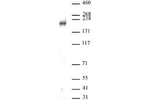 DOT1L antibody (pAb) tested by Western blot. (DOT1L 抗体  (C-Term))