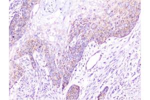IHC analysis of cortactin using anti-cortactin antibody (ABIN6719306). (Cortactin 抗体  (AA 1-105))