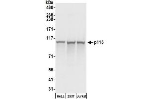 Western Blotting (WB) image for anti-rho GTPase Activating Protein 4 (ARHGAP4) (AA 912-962) antibody (ABIN7455040) (ARHGAP4 抗体  (AA 912-962))