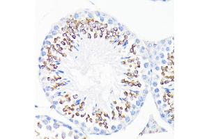 Immunohistochemistry (IHC) image for anti-Cathelicidin Antimicrobial Peptide (CAMP) (AA 31-170) antibody (ABIN3022306)
