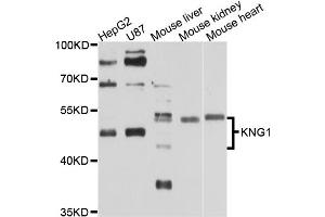 Western blot analysis of extracts of various cell lines, using KNG1 antibody (ABIN5970830) at 1/1000 dilution. (KNG1 抗体)