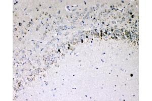 IHC analysis of IL-16 using anti-IL-16 antibody (ABIN5518927).