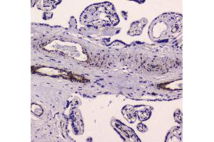 IHC analysis of MYLK using anti-MYLK antibody . (MYLK 抗体  (AA 1441-1709))