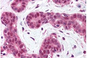 Human Breast (formalin-fixed, paraffin-embedded) stained with BCL10 antibody ABIN214584 at 5 ug/ml followed by biotinylated goat anti-rabbit IgG secondary antibody ABIN481713, alkaline phosphatase-streptavidin and chromogen. (BCL10 抗体  (N-Term))