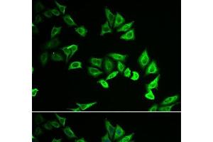 Immunofluorescence analysis of U2OS cells using MYOZ2 Polyclonal Antibody (MYOZ2 抗体)