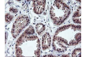 Immunohistochemical staining of paraffin-embedded Human breast tissue using anti-PDLIM2 mouse monoclonal antibody. (PDLIM2 抗体)