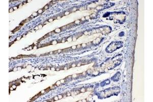 Immunohistochemistry (IHC) image for anti-Cytochrome P450, Family 2, Subfamily D, Polypeptide 6 (CYP2D6) (AA 315-347) antibody (ABIN5647528)