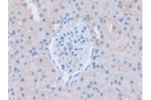 IHC-P analysis of Rat Kidney Tissue, with DAB staining. (ITSN1 抗体  (AA 1-227))