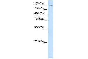 WB Suggested Anti-SMARCA3 Antibody Titration:  5.