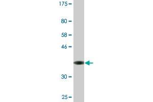 Western Blot detection against Immunogen (36. (MAP3K13 抗体  (AA 711-810))