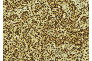 Immunohistochemistry (IHC) image for anti-Nuclear Factor of kappa Light Polypeptide Gene Enhancer in B-Cells 2 (NFKB2) (C-Term) antibody (ABIN6263614)