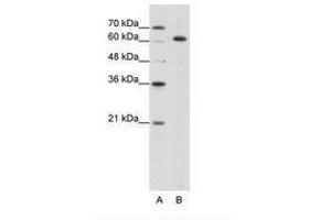 Image no. 2 for anti-Small Nuclear Ribonucleoprotein 70kDa (U1) (SNRNP70) (AA 21-70) antibody (ABIN203140) (SNRNP70 抗体  (AA 21-70))