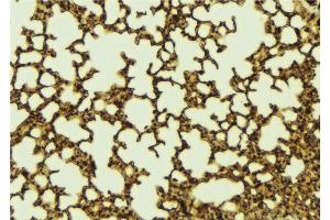 ABIN6267185 at 1/100 staining Mouse lung tissue by IHC-P. (NCOA3 抗体  (pThr24))