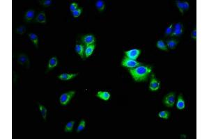 Immunofluorescence staining of HepG2 cells with ABIN7146784 at 1:333, counter-stained with DAPI. (CEACAM1 抗体  (AA 35-428))