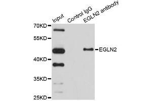 Immunoprecipitation analysis of 150ug extracts of HeLa cells using 3ug EGLN2 antibody. (PHD1 抗体)