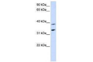 SLC25A34 antibody used at 1 ug/ml to detect target protein. (SLC25A34 抗体  (Middle Region))