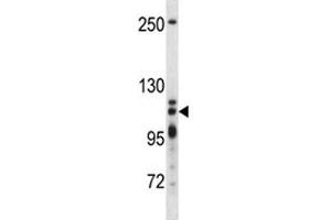 XRN2 antibody western blot analysis in T47D lysate (XRN2 抗体  (AA 48-76))