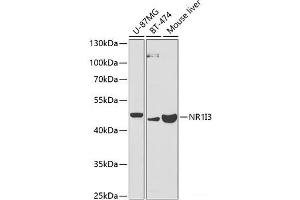 Western blot analysis of extracts of various cell lines using NR1I3 Polyclonal Antibody at dilution of 1:1000. (NR1I3 抗体)