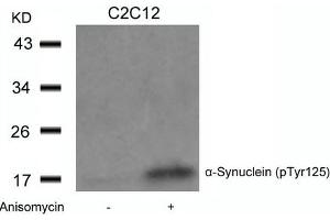 Western blot analysis of extracts from C2C12 cells untreated or treated with Anisomycin using a-Synuclein(Phospho-Tyr125) Antibody. (SNCA 抗体  (pTyr125))