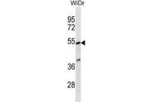 Western Blotting (WB) image for anti-Phosphatidylinositol Glycan Anchor Biosynthesis, Class V (PIGV) (AA 342-371), (C-Term) antibody (ABIN954140)