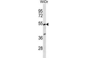 Western blot analysis in WiDr cell line lysates (35ug/lane) using PIGV  Antibody (C-term).