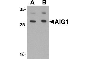 Western blot analysis of AIG1 in human brain tissue lysate with AIG1 antibody at (A) 1 and (B) 2 µg/mL. (AIG1 抗体  (N-Term))