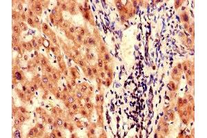 Immunohistochemistry of paraffin-embedded human liver tissue using ABIN7153235 at dilution of 1:100 (FAH 抗体  (AA 2-250))