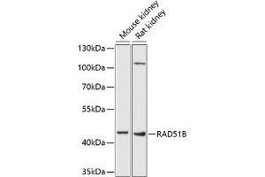 Western blot analysis of extracts of various cell lines, using RB antibody (ABIN6132613, ABIN6146640, ABIN6146643 and ABIN6222714) at 1:1000 dilution. (RAD51 Homolog B 抗体  (AA 1-384))
