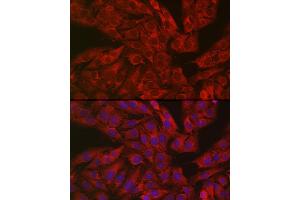 Immunofluorescence analysis of U2OS cells using GSDME antibody (ABIN6127757, ABIN6139554, ABIN6139555 and ABIN6223304) at dilution of 1:50. (Non-Syndromic Hearing Impairment Protein 5 (GSDME) (AA 1-260) 抗体)