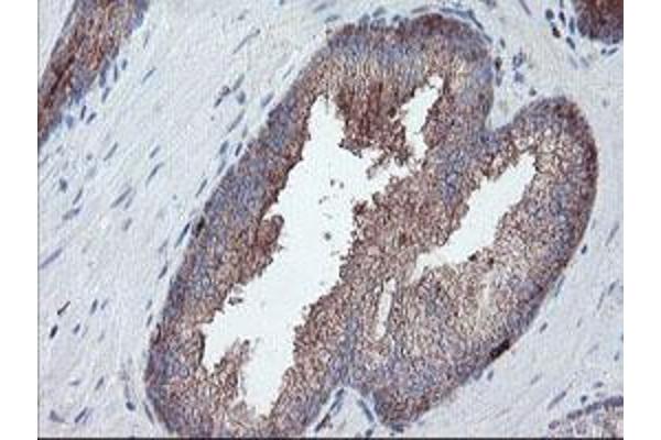 Carboxypeptidase A2 抗体