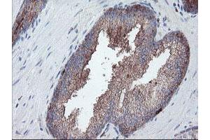 Image no. 12 for anti-Carboxypeptidase A2 (Pancreatic) (CPA2) antibody (ABIN1497596) (Carboxypeptidase A2 抗体)