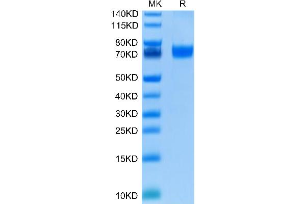 VTCN1 Protein (AA 33-194) (Fc Tag)