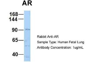 Host: Rabbit Target Name: AR Sample Type: Human Fetal Lung Antibody Dilution: 1. (Androgen Receptor 抗体  (N-Term))