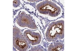 Immunohistochemical staining of human uterus, pre-menopause with OR2AE1 polyclonal antibody  shows distinct membranous positivity in glandular cells at 1:50-1:200 dilution. (Olfactory Receptor, Family 2, Subfamily AE, Member 1 (OR2AE1) 抗体)
