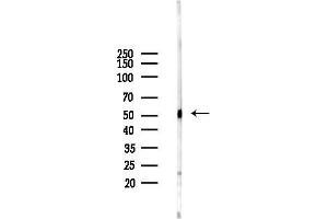 anti-Macrophage Receptor with Collagenous Structure (MARCO) antibody
