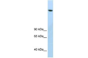 WB Suggested Anti-JMJD1B Antibody Titration:  2. (KDM3B 抗体  (C-Term))