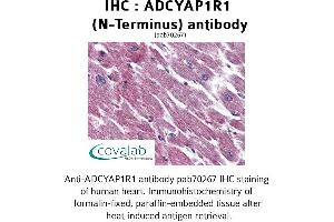 Image no. 2 for anti-Adenylate Cyclase Activating Polypeptide 1 (Pituitary) Receptor Type I (ADCYAP1R1) (Extracellular Domain), (N-Term) antibody (ABIN1731541) (ADCYAP1R1 抗体  (Extracellular Domain, N-Term))